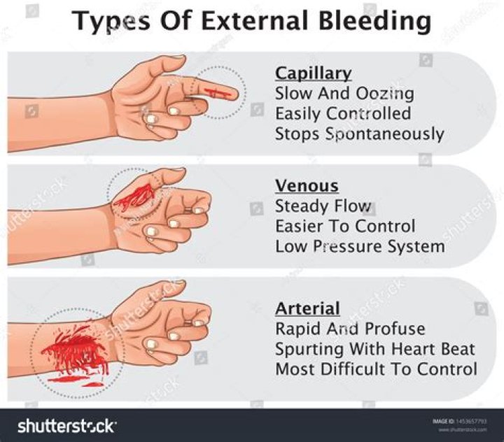 Bleed