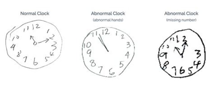 Broken Clock vs Normal Clock