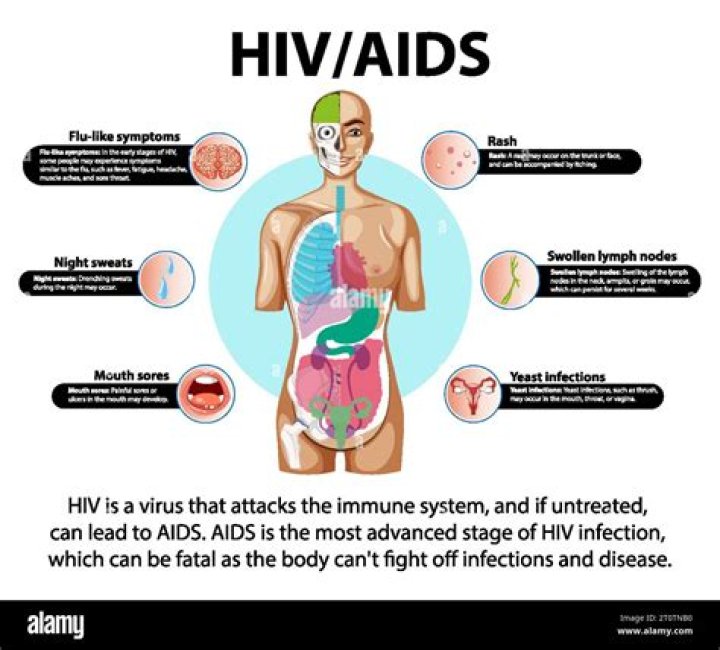 Dire AIDS - Kills you slowly, but faster than regular AIDS. Not curable by normal means.