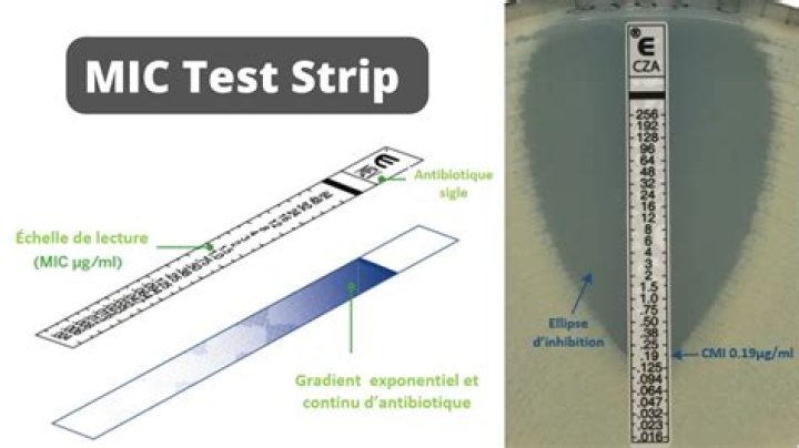 example of Mic detected
