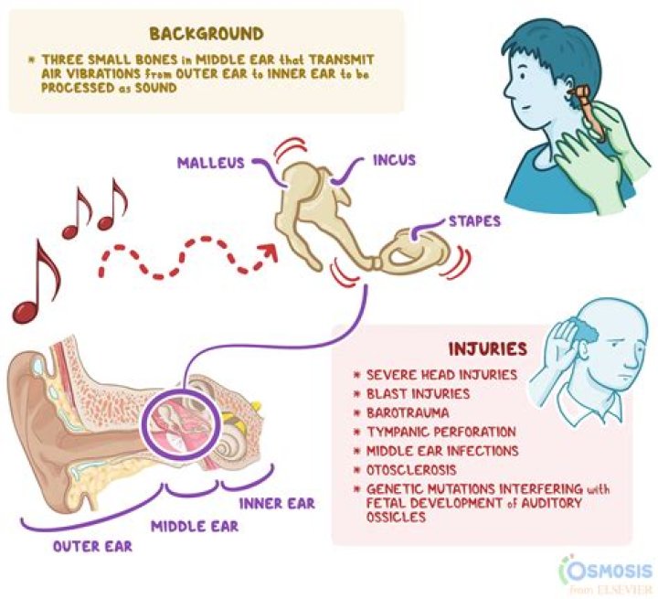 How can I get the Babel Fish in my ear?