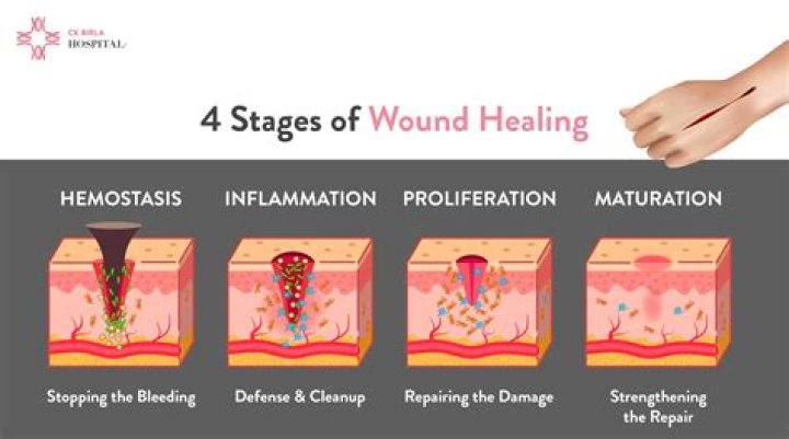 How can I heal with arrows?
