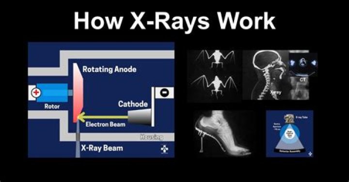 How can I scan x-rays on a flatbed scanner?