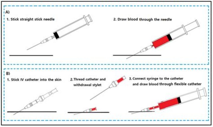 How do I get a blood sample from the Manbat?
