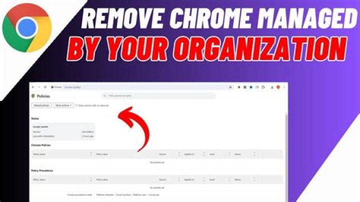 How to I remove 