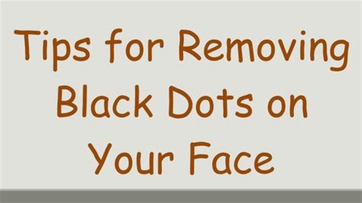 Removing black dots from li and ul [duplicate]