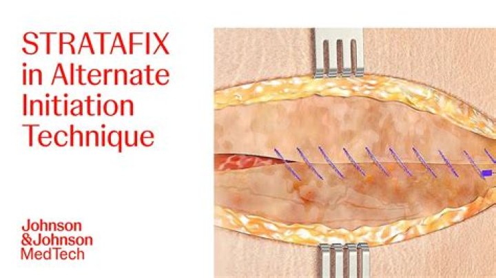 Symmetric surgery