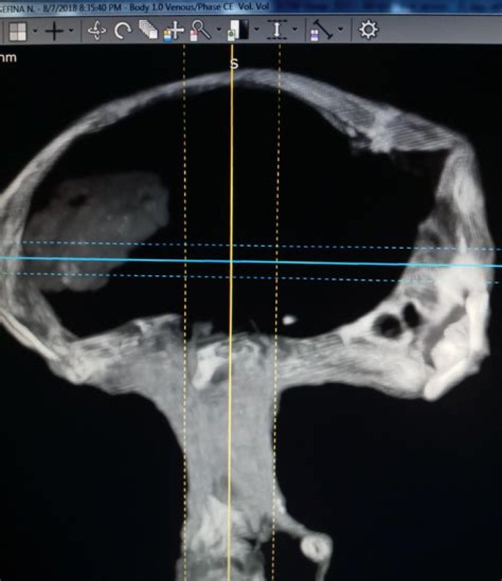 vibrant chest normal head