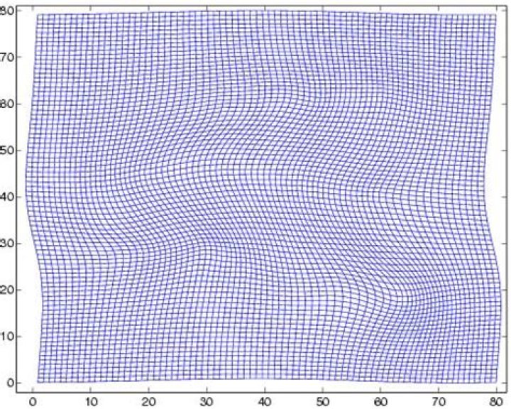 What is a diffeomorphism?