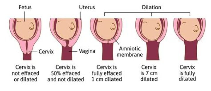 What is a dilation surface?